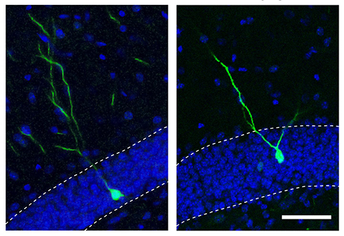 Salk study shows the microRNA (miRNA) miR-19 helps budding adult brain cells stay on track. Overexpessing miR-19 miRNA in neural progenitor cells in the adult brain of mice caused new neurons (green) to move and branch abnormally (right) compared to control neurons (left). [Salk Institute]