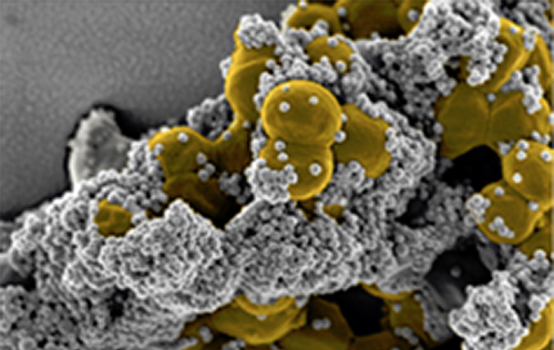 Magnetic nanobeads attached to <i>S. aureus</i>. [PloS One]” /><br />
<span class=