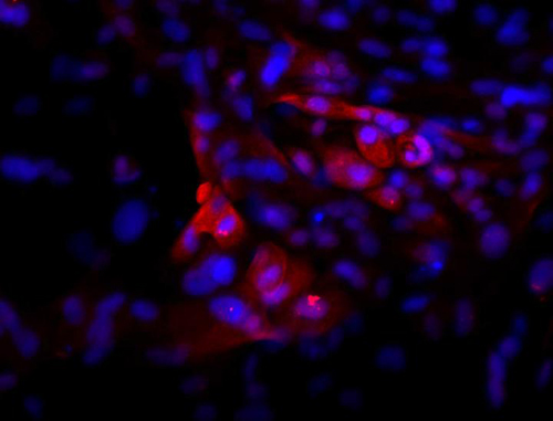 Immunofluorescence image of pituitary cells derived from human pluripotent stem cells. The cells shown here were stained for ACTH (red) and DNA/nucleus (blue) 30 days after differentiation. Similar cells were used in transplantation studies to partly rescue a rat model of hypothyroidism. [Bastian Zimmer, Sloan Kettering Institute]
