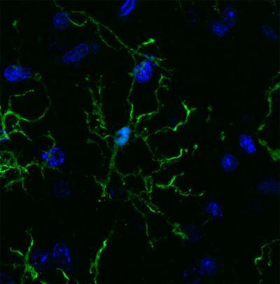 Salk and UC San Diego scientists conducted a vast survey of microglia (pictured here), revealing links to neurodegenerative diseases and psychiatric illnesses. [Nicole Coufal]