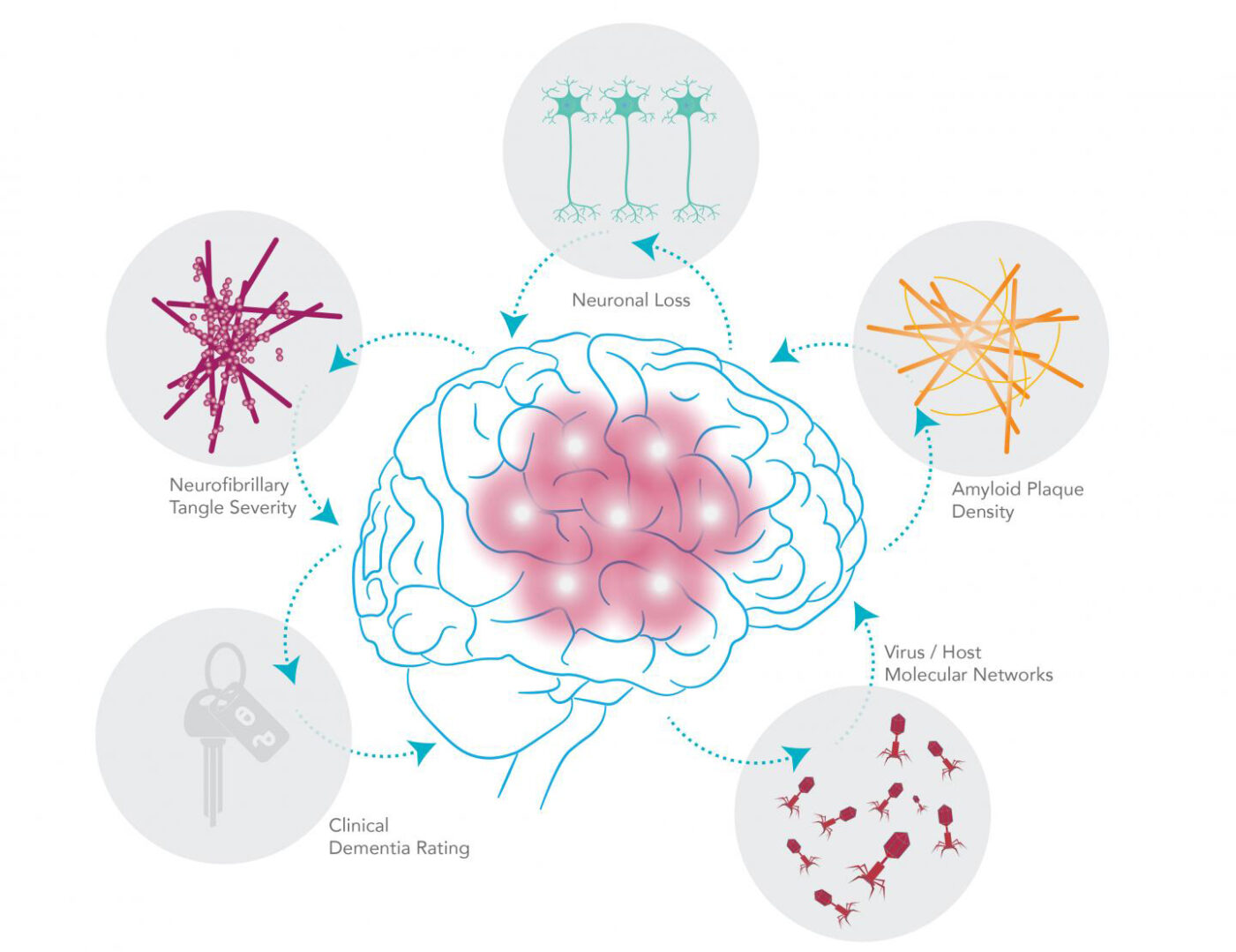 Viral–host networks, including genes and RNA transcripts, interact in complex ways. A pair of herpesviruses—HHV 6A and 7—were found in greater abundance in brain samples from AD patients compared with normal brains. These viruses seem to also be implicated in the AD-related genetic networks responsible for classic Alzheimer's pathology, including cell death, the deposition of amyloid plaque, and production of neurofibrillary tangles. [Shireen Dooling for the Biodesign Institute at ASU]