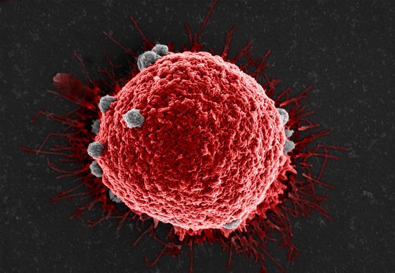 Image of FcMBL-coated beads (gray) attached to a tumor cell (red). [Wyss Institute at Harvard University]