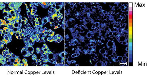 A fluorescent probe creates a heat map of copper in white fat cells. Higher levels of copper are shown in yellow and red. The left panel shows normal levels of copper from fat cells of control mice and the right panel shows cells deficient in copper. [Lakshmi Krishnamoorthy and Joseph Cotruvo, Jr./UC Berkeley]