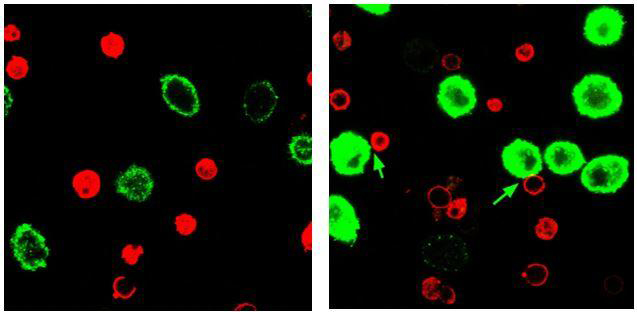 T cells (red) and tumor cells (green) incubated with control particles (left) or immunoswitch particles (right). T cells that have latched on to tumor cells are indicated by green arrows. [Alyssa Kosmides/Johns Hopkins Medicine]