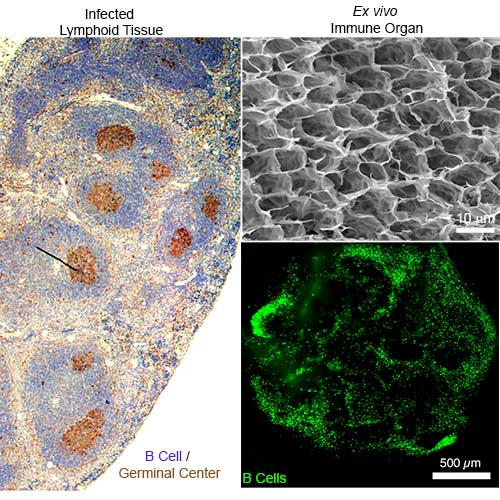 Left: activated B cells in mouse spleen. Right, top: synthetic immune organ that enables rapid proliferation and activation of B cells. Right, bottom: B cell viability and distribution 24 hours post-encapsulation. [Singh Lab]