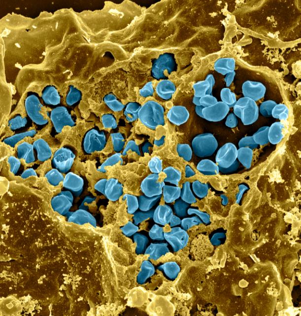Scanning electron micrograph of a murine macrophage infected with <i>Francisella tularensis</i> strain LVS. Macrophages were dry-fractured by touching the cell surface with cellophane tape after critical point drying to reveal intracellular bacteria. Bacteria (colorized in blue) are located either in the cytosol or within a membrane-bound vacuole. [NIAID]” /><br />
<span class=