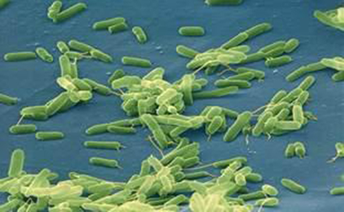 This is a sample of <i>Clostridium difficile</i> bacteria. [UTHealth Office of Public Affairs]” /><br />
<span class=