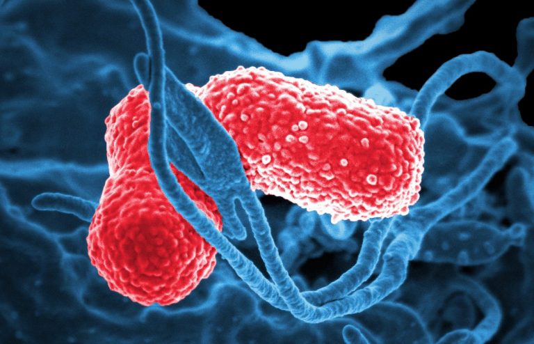 Bacteria Resistant to Colistin Present Serious Clinical Challenge