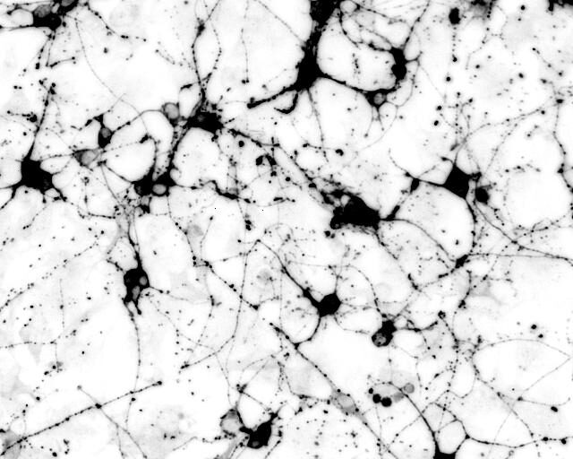 Mouse induced neurons generated from a novel transcription factor pair Neurog2/Brn2. Cells stained for neuron-specific beta-III tubulin expression (Tuj1). [Baldwin Lab/The Scripps Research Institute]
