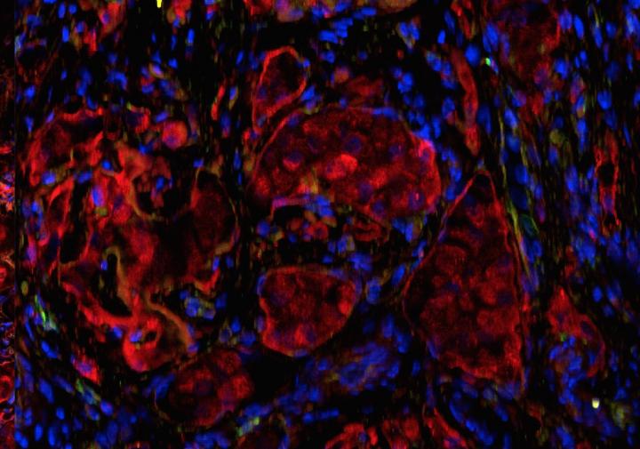Fluorescence microscopy of islets in the omentum transplanted within the biologic scaffold. Red indicates insulin staining; blue indicates DAPI nuclear staining. [Diabetes Research Institute/University of Miami Miller School of Medicine]