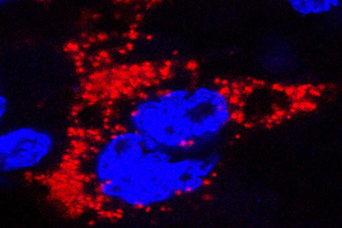 Two mouse models of Zika virus infection in pregnancy were developed by researchers at Washington University School of Medicine in St. Louis. The models provide a basis to develop vaccines and treatments, and to study the biology of Zika virus infection in pregnancy. In this photo, Zika virus, marked with red, infects a mouse placenta. The nuclei of the placental cells are marked blue. [Bin Cao]