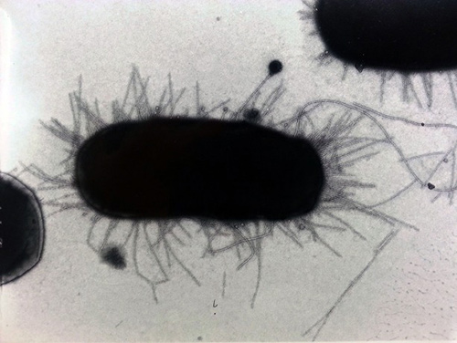 E. coli bacteria showing the appendages used to adhere to other cells. [Sokurenko Lab/University of Washington]