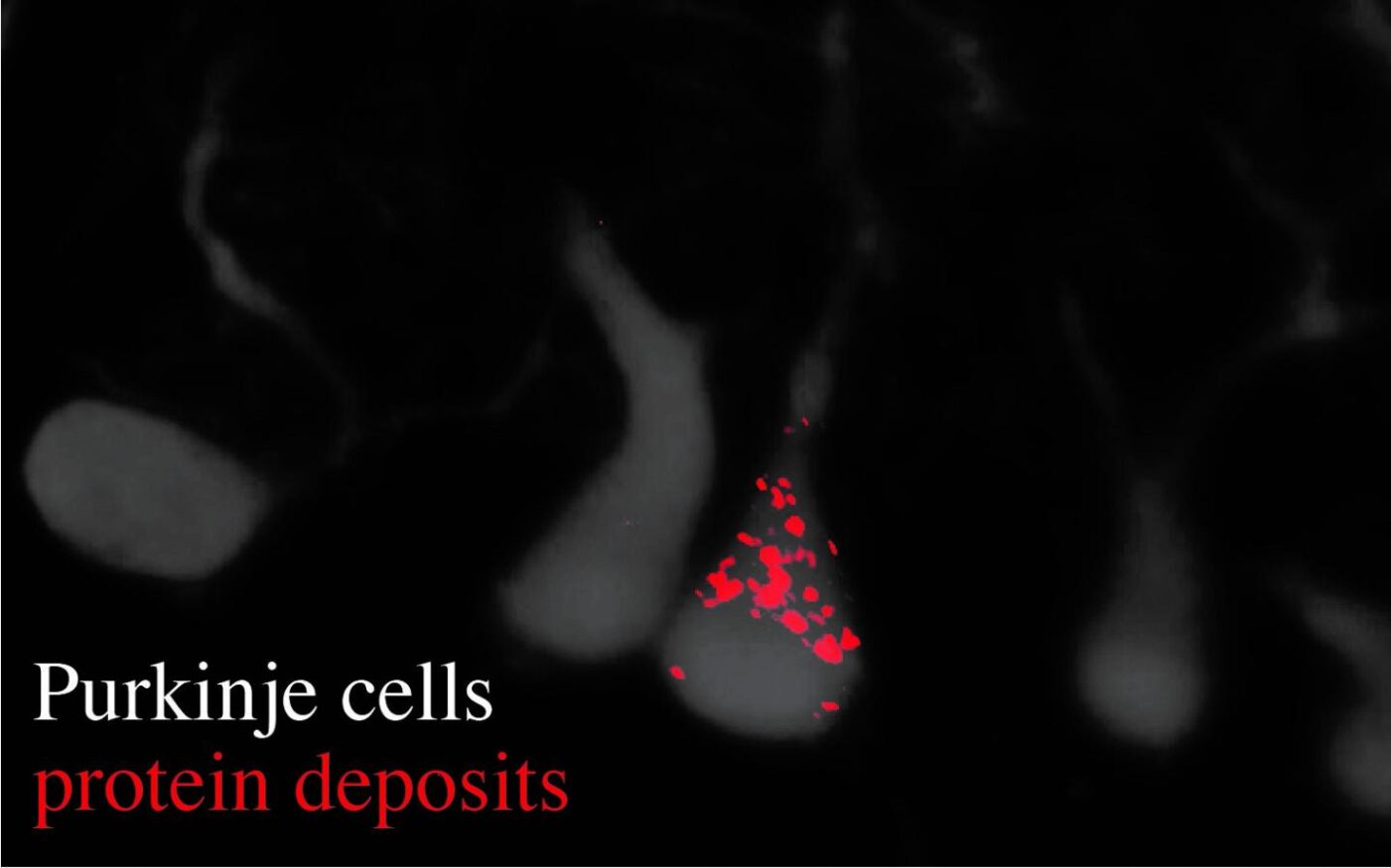Image reveals Purkinje cells (gray) and their dendrites, as well as an accumulation of protein deposits (red dots). [Ackerman Lab/UC San Diego]