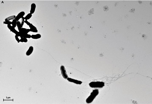 The ability of amyloid-beta (Aß)  to form aggregates and trap bacterial pathogens has been demonstrated both in culture and also in mouse and worm models. This image shows Aß fibrils propagating from yeast cells in culture medium. Such fibrils mediate agglutination and eventually imprison unattached microbes. [D.K.V. Kumar et al./Science Translational Medicine (2016)]
