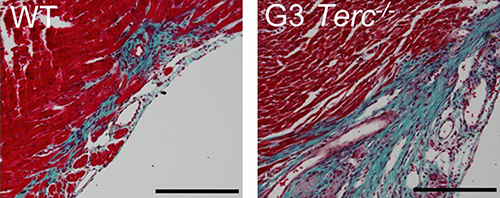 Telomerase-deficient mice undergo premature telomere shortening, and so, unlike wild-type mice, they are unable to regenerate damaged heart tissue, even at day 1 of age. Twenty-eight days after injury, telomerase-deficient heart tissue (right) has larger fibrotic regions (blue) compared with wild-type myocardium (left). [Aix et al., 2016, The Journal of Cell Biology]