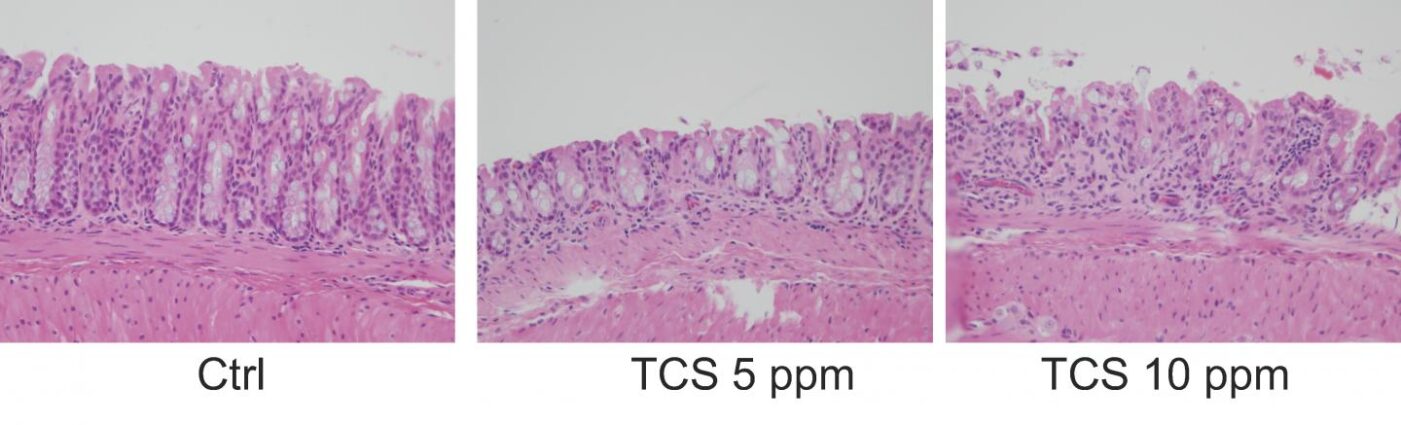 Exposure to triclosan (TCS) exacerbated the severity of colitis and inflammation in mice.  [H. Yang et al., Science Translational Medicine (2018)]