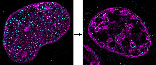 DNA forms highly unusual, dense clusters when cells are starved of oxygen and nutrients. These images, obtained by super-resolution microscopy, show DNA in a cell nucleus under normal (left) and ischemic (right) conditions. [Aleksander Szczurek, Ina Kirmes]
