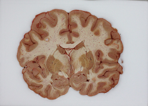 The Allen Human Brain Atlas, a data set derived from analyses of tissue samples such as the one shown here, was used in an investigation of differential transcription across 132 structures in six individual brains. The investigation revealed that a set of just 32 gene-expression signatures defines, in large part, a common network architecture that is conserved across the human population. [Allen Institute for Brain Science]