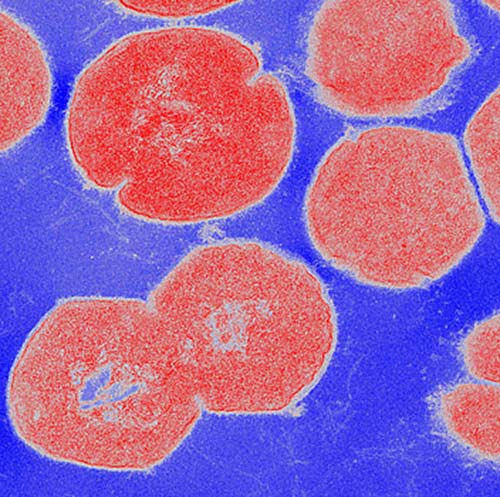 Group A Streptococcus bacteria (red) coat their surfaces with M1 proteins (white), which sequester and neutralize natural antibiotics produced by the human body. [UC San Diego Health]