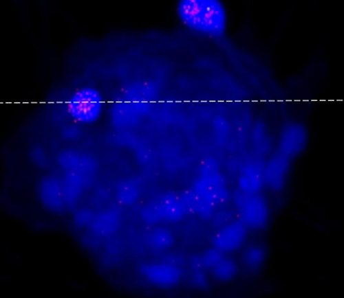 A cell (in blue) with the ATCV-1 viral particles.[University Communications/University of Nebraska-Lincoln]