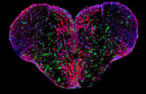 The zebrafish brain has an outstanding regenerative ability, which also manifests after neurodegenerative disease-like conditions. Dr. Caghan Kizil and colleagues generated an Alzheimer's disease model in the adult zebrafish brain and showed that this remarkable aptitude is enabled by a specific neuro-immune crosstalk. This dynamic interplay activates the proliferation of neural stem cells and subsequently triggers the formation of new neurons. The image shows the spatial organization of immune cells (green) and neurons (red) on a cross section of adult zebrafish forebrain (cell nuclei, blue). [Kizil Lab]