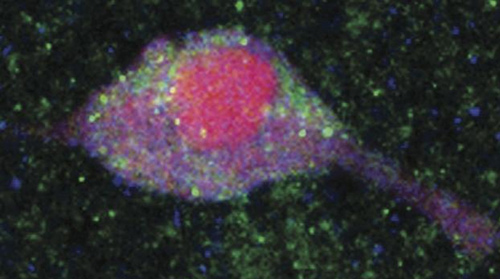 Image of a rodent brain cell, with insulin receptors (green dots) that when activated spur release of dopamine. The neuron nucleus is shown in the background (pink). [Nature Communications]