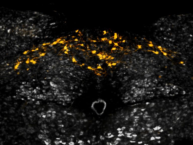 Obesity, Wasting Syndrome Both Wired into Hormonal Emergency Circuit