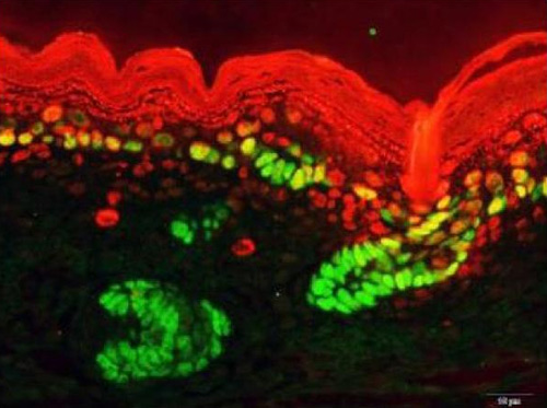 Immunofluorescence of skin differentiation markers for basal keratinocytes. [Russ Carstens, M.D., Perelman School of Medicine, University of Pennsylvania; eLife]