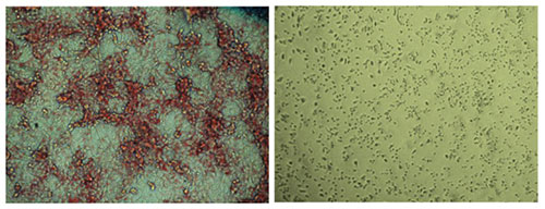 Salk Institute researchers and collaborators develop novel cancer treatment that halts fat synthesis in cells. Placebo-treated cells (left) have far more lipid (red) production compared to ND-646–treated cells (right). [Salk Institute]