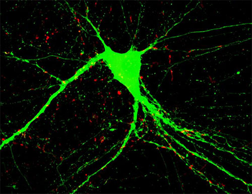Cultured neuron with an added BDNF protein. [Duke-NUS Graduate Medical School Singapore]