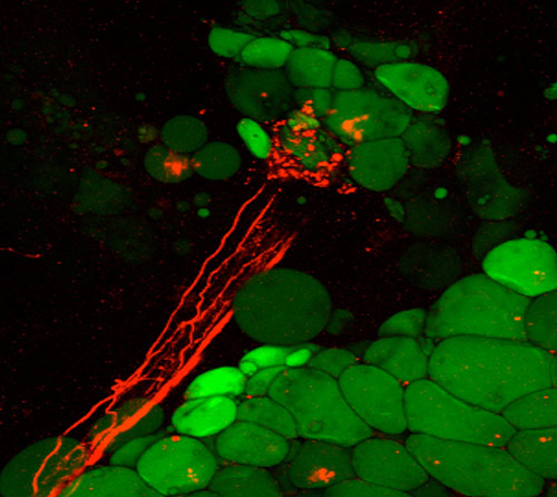 Microscopic image of fat cells (green) encapsulated by nerve axons (red) in mice. [Roksana Pirzgalska, IGC]