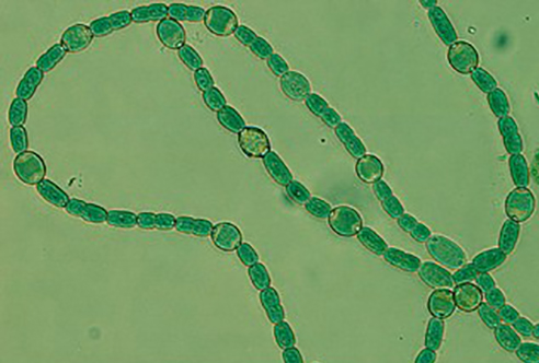 Light micrograph of cyanobacteria from the <i>Anabaena</i> genus. [DOE]” /><br />
<span class=