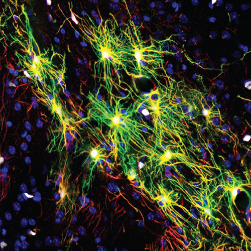 Human astrocytes in a mouse brain. [NIH]