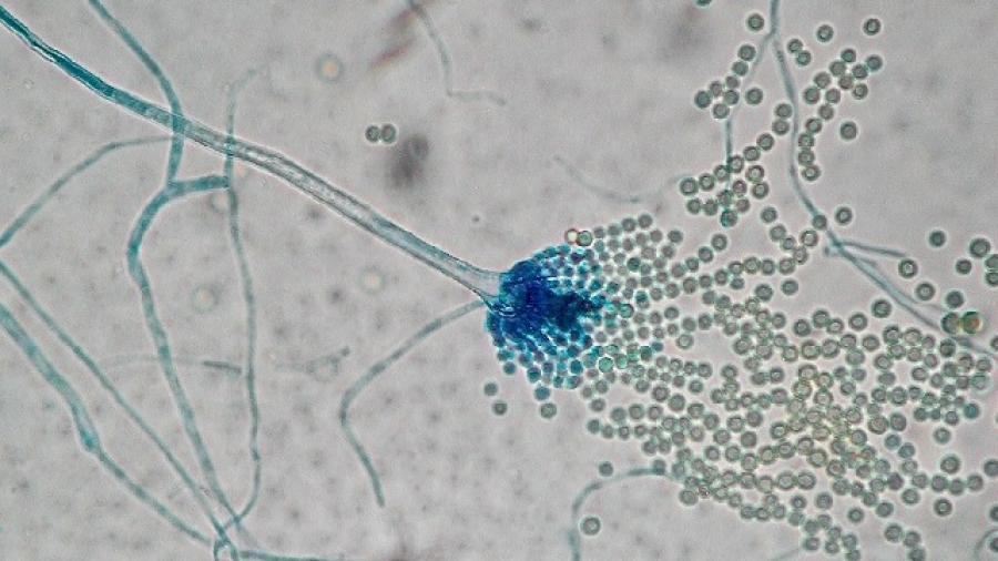 View by microscopy of a sporulating <i>Aspergillus</i>, showing numerous light spores that can be easily aerosolized and inhaled together with mycotoxins. [Sylviane Bailly/Université de Toulouse]” /><br />
<span class=