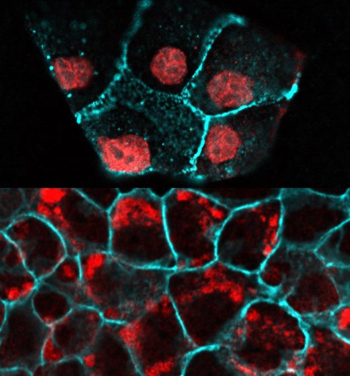 By sensing mechanical tensions, the transmembrane protein Piezo1 (red) helps trigger cell division or cell death, thereby maintaining healthy cell density. Division is triggered in the case of stretching (when cells are sparse). Cell expulsion, and subsequent cell death, is triggered in the case of crowding. [Swapna Gudipaty/Huntsman Cancer Institute]