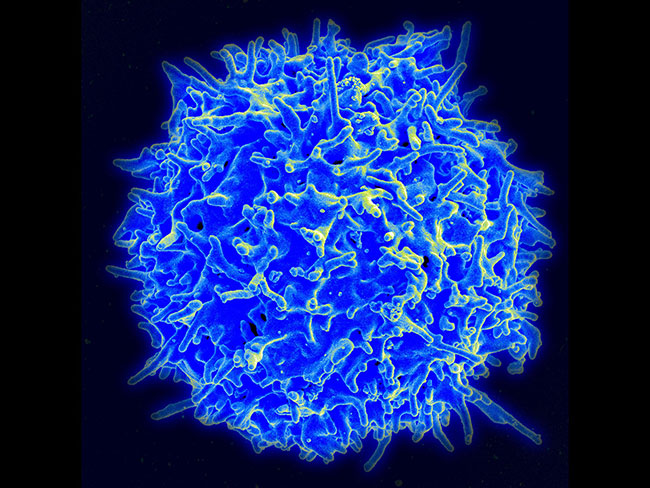 In cellular immunotherapy, healthy T cells (above) are removed from patients, genetically engineered to target their cancer, and injected back into the body. [NIAID]