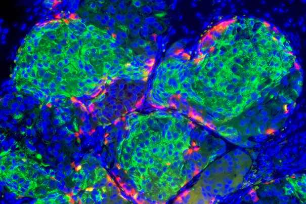Insulin-producing pancreatic beta cells (green) derived from human embryonic stem cells that have formed islet-like clusters in a mouse. [NIH]