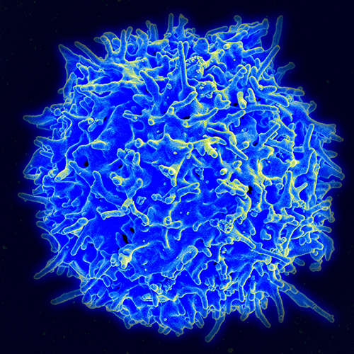 Outsource a part of the T cell’s immune value chain, propose cancer immunotherapy researchers, from patient T cells to donor T cells. The novel allogeneic approach could rely on T-cell receptor gene transfer to generate broad and tumor-specific T-cell immune responses. [NIAID]