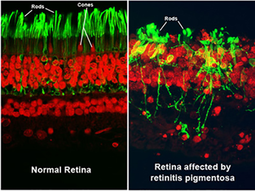New research seeks to use gene-editing techniques to prevent retinal damage from an inherited blindness disorder. [NEI/NIH]