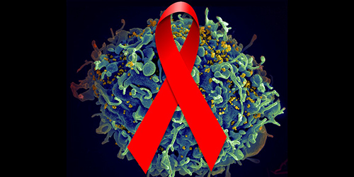 Investigators found that administering vaccine plus immune stimulant reduced hard-to-reach reservoirs of HIV-like virus in animal model. [NIH]