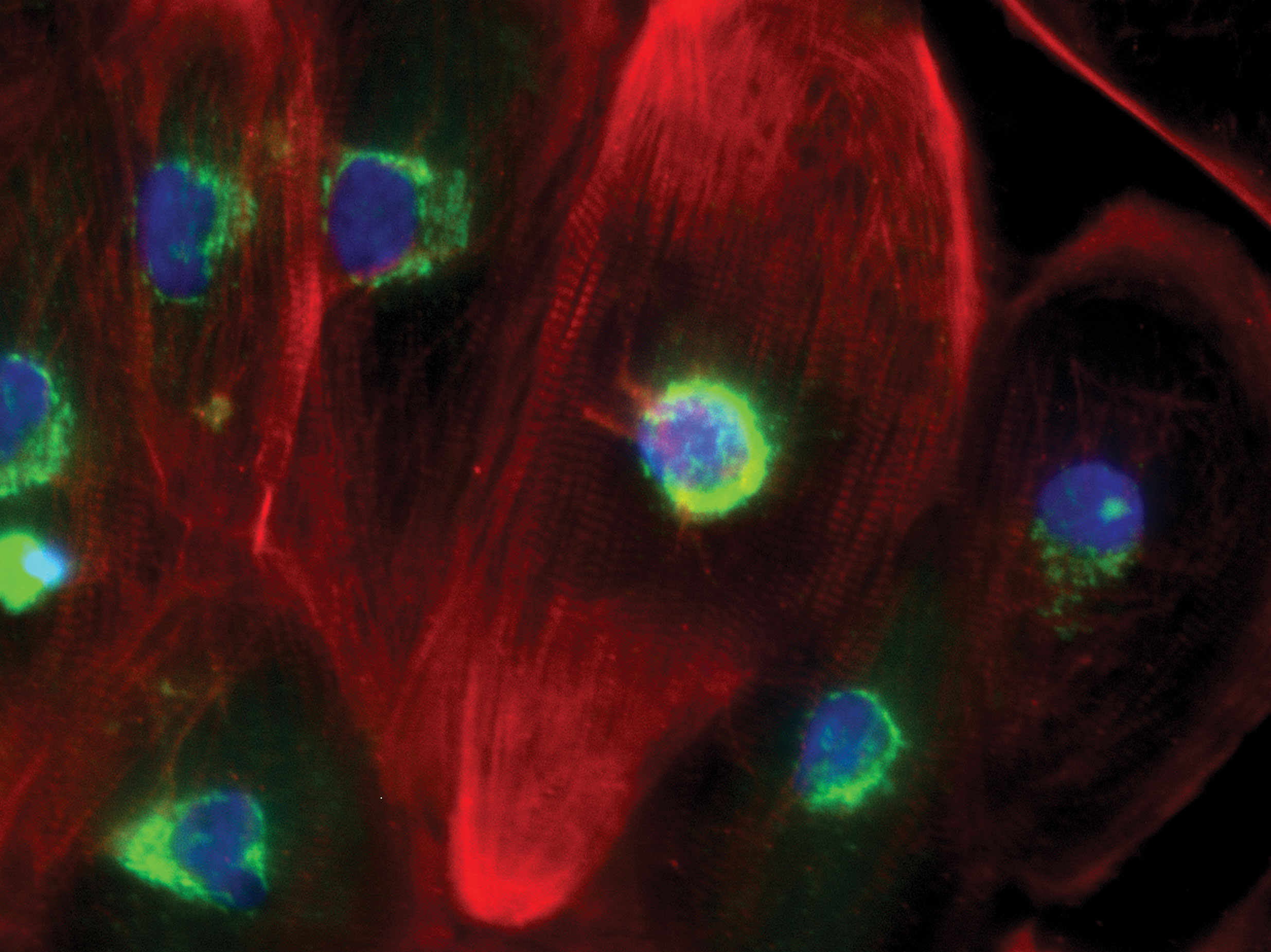 hiPSC-derived Cardiomyocytes