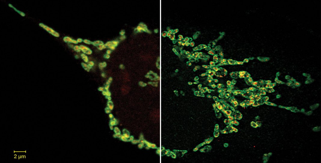 super-resolution-microscopy-breaking-the-diffraction-barrier