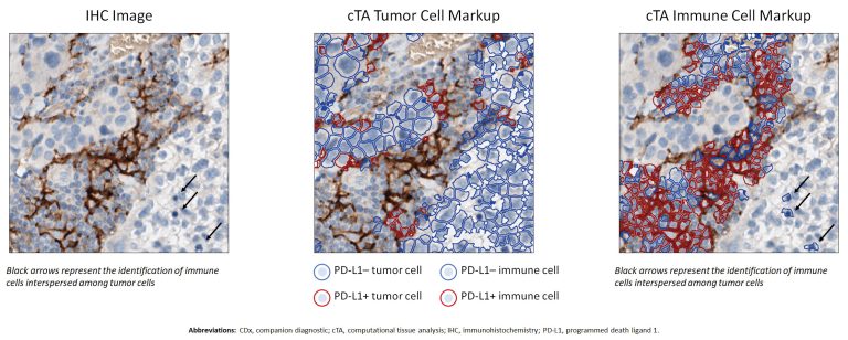 Precision Biomarkers and Medicines Go Global