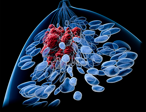 Key Regulator of Breast Cancer Metastasis Unveiled