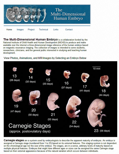 The Multi Dimensional Human Embryo Best Of The Web