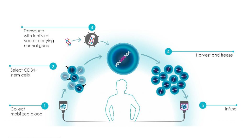 Gene Therapy for Rare Diseases