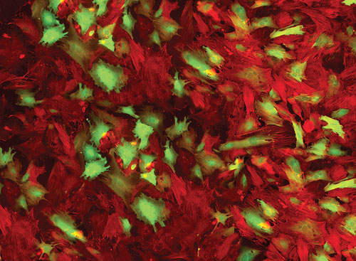 Transfection Methods in Gene Therapy