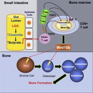 Probiotic May Represent Bone-Boosting Therapy For Osteoporosis