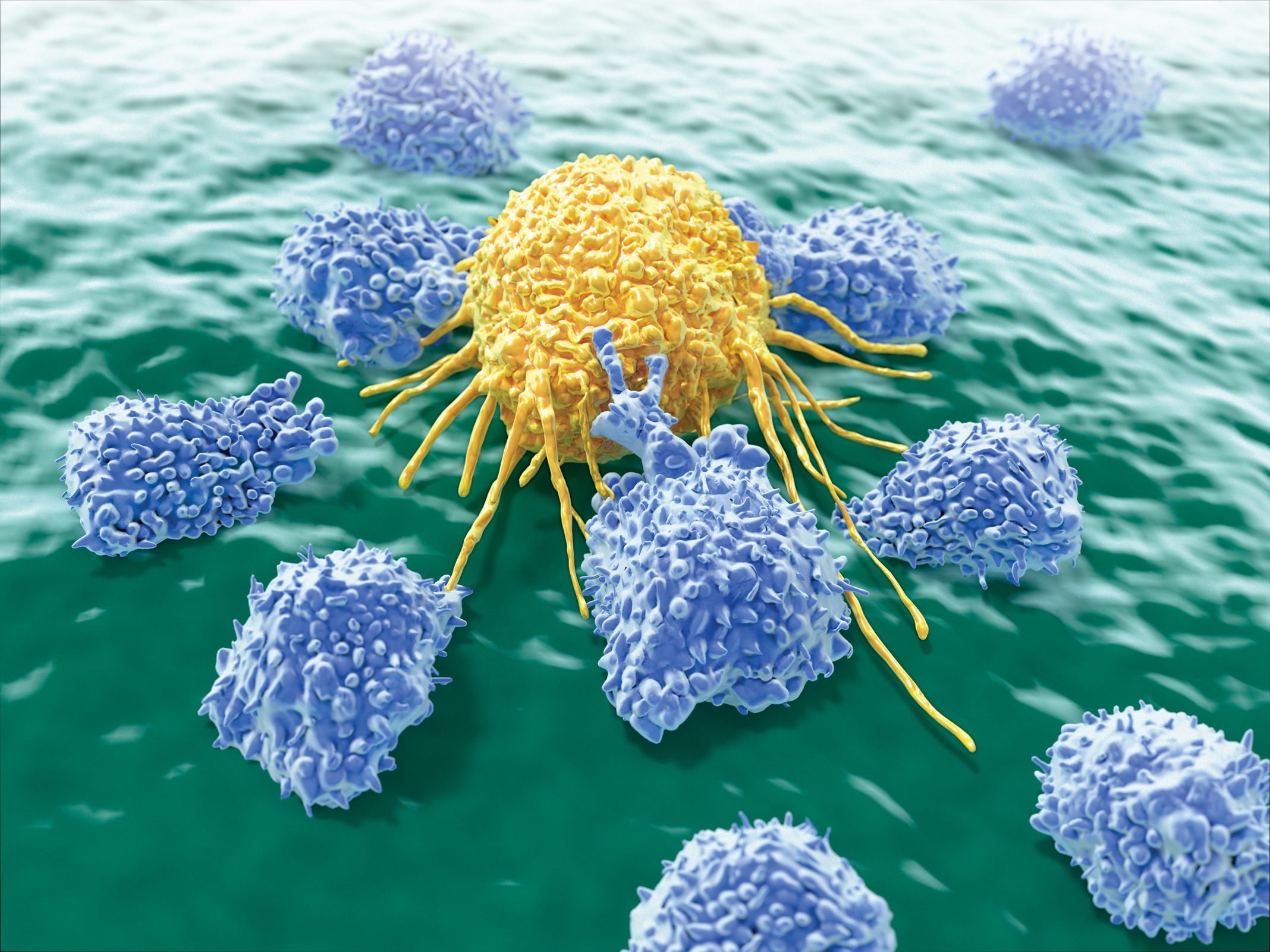 Natural Killer Cells Emerge As An Anticancer Alternative To T Cells