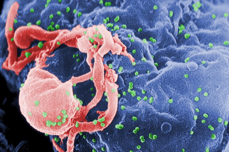 HIV Protein Trains Immune Cells to Be Hyper-Responsive, Resulting in Chronic Inflammation